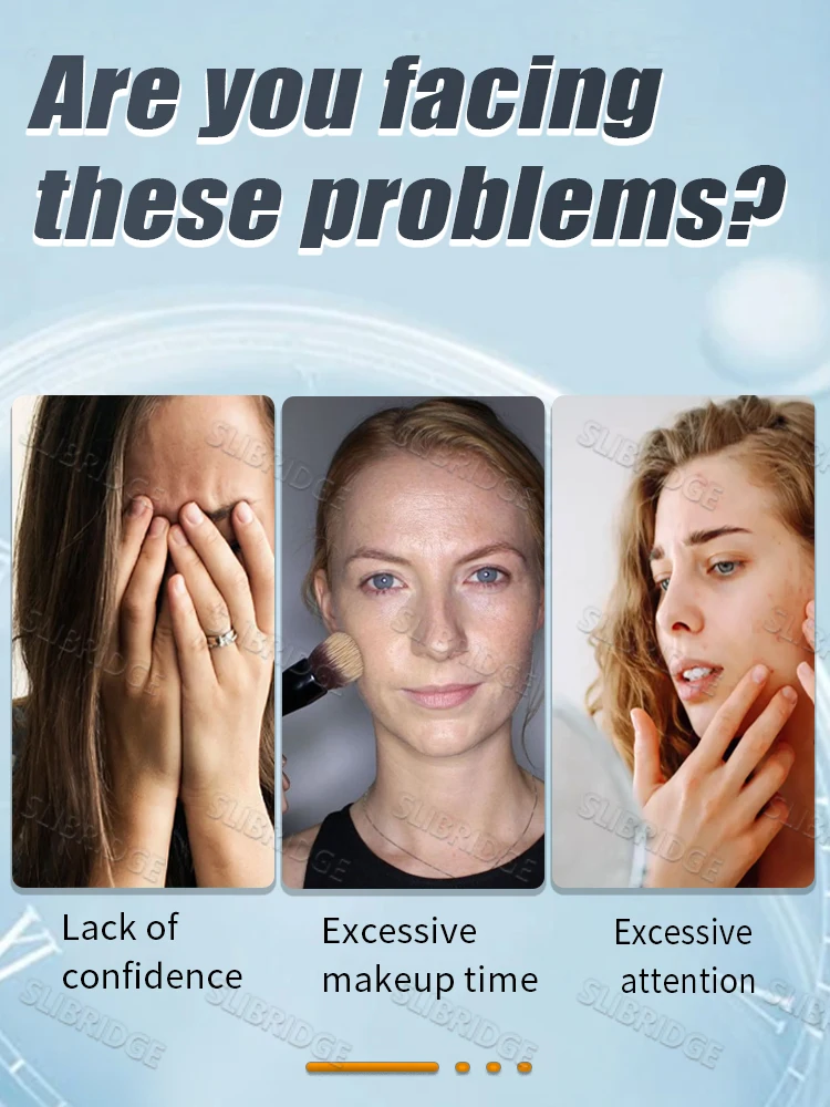 Solve facial skin problems, gentle and effective, suitable for all skin types, a best-selling product in 2026.