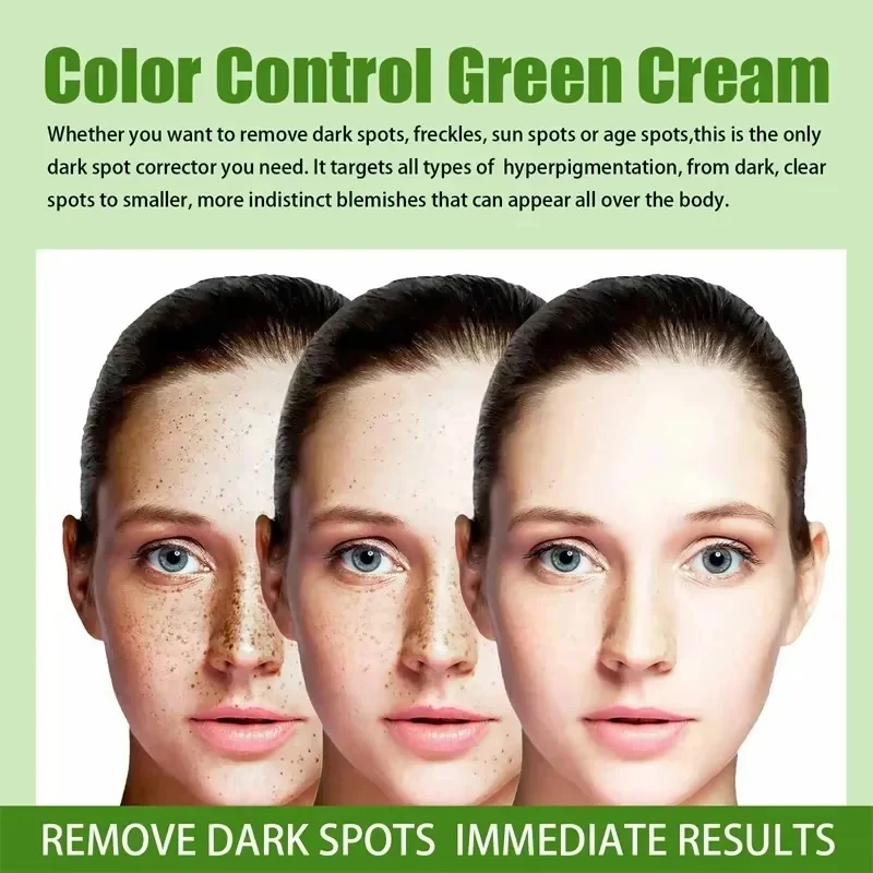 Whitening Freckle Face Cream Remove Melasma Dark Spot Lightening Melanin Brightening Melasma Anti-Aging Skin Care Beauty Product