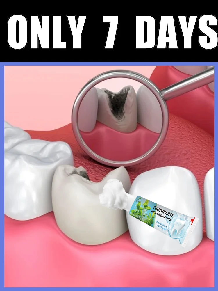 

2025 Hot Products,Teeth cleaning care tools,free shipping