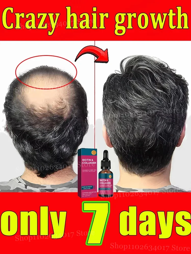

Hair growth essential oil, anyone with baldness and hair loss should buy this product. It has helped millions of people say good