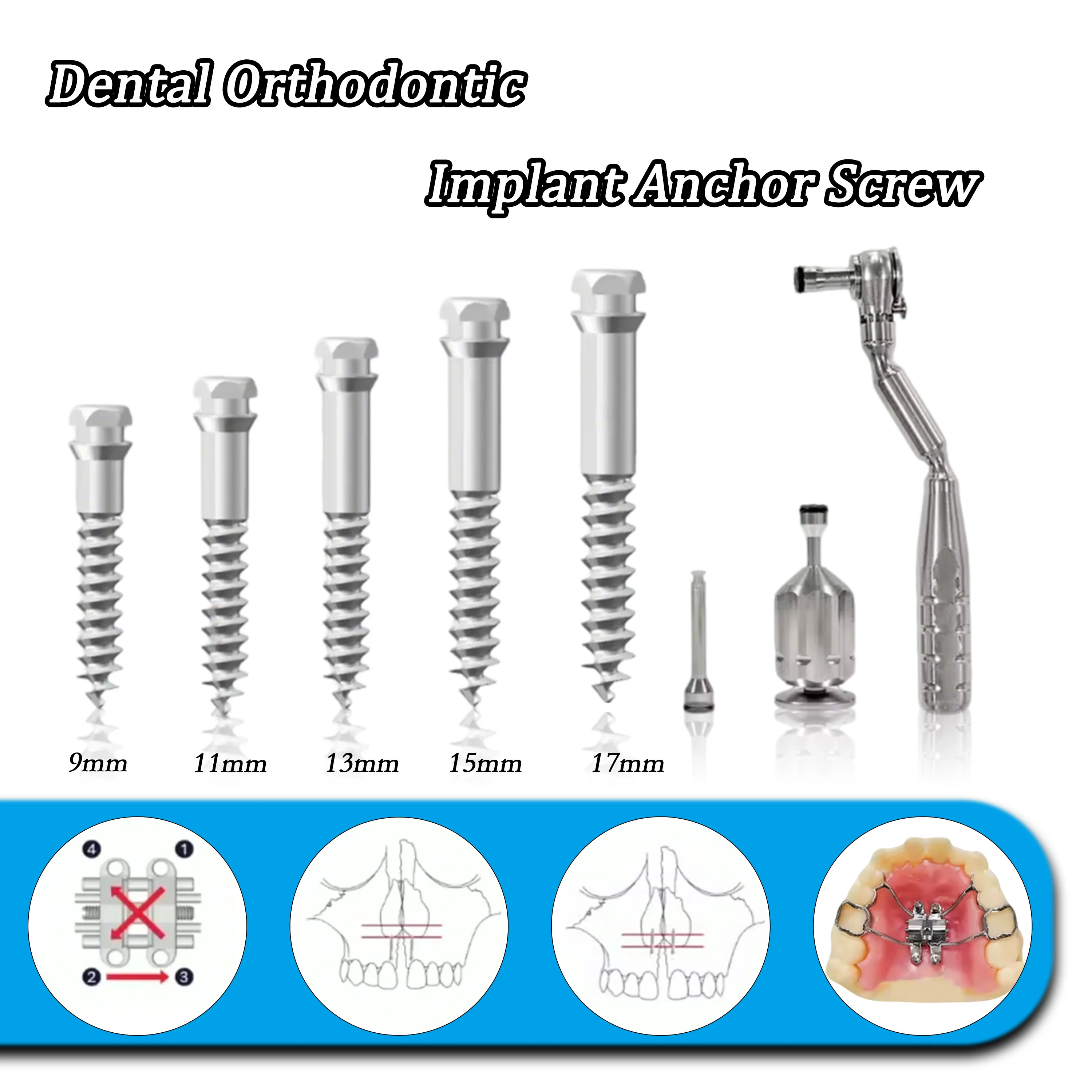 

Набор ортодонтических мини-винтов для расширения кости 1.8x9/11/13/15/17 мм, самонарезающие костные анкерные винты с отверткой и динамометрическим ключом