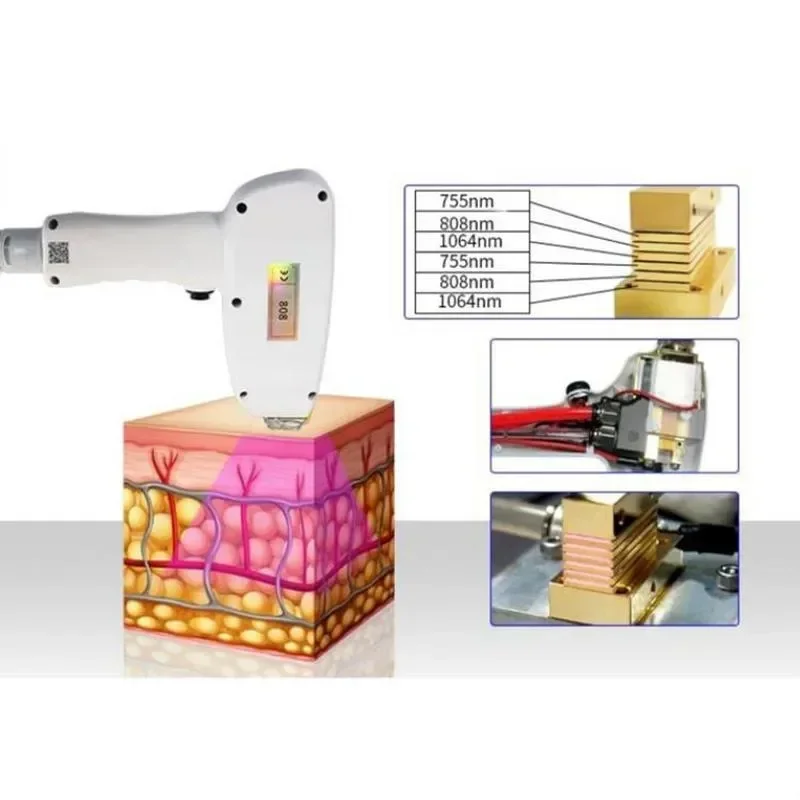 Diode Laser Hair Removal Machine Professional Man Laser Almalasers Ice Titanium 808 Nm1064 Nm Laserhairremoval Machine
