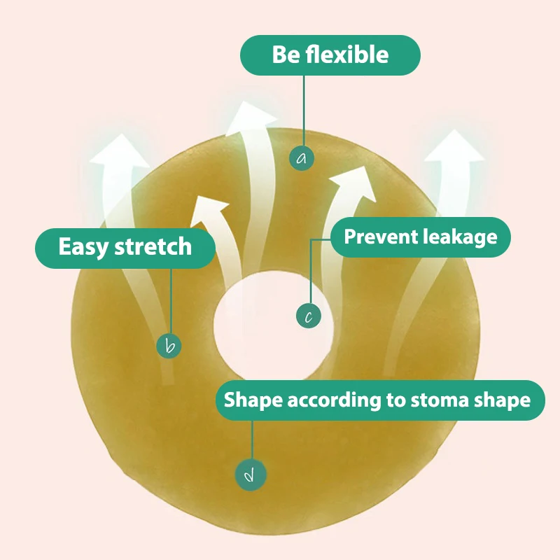 Ostomy Paste Ring Baseplates Care Products Leak-Proof Ring For Ostomy Bag
