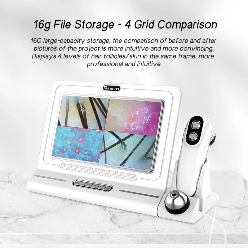 Skin Analyzer 11 Inch, Scalp Analysis Machine, Beauty Salon Device, Hair Loss Detection Camera, Facial Skin Scanner