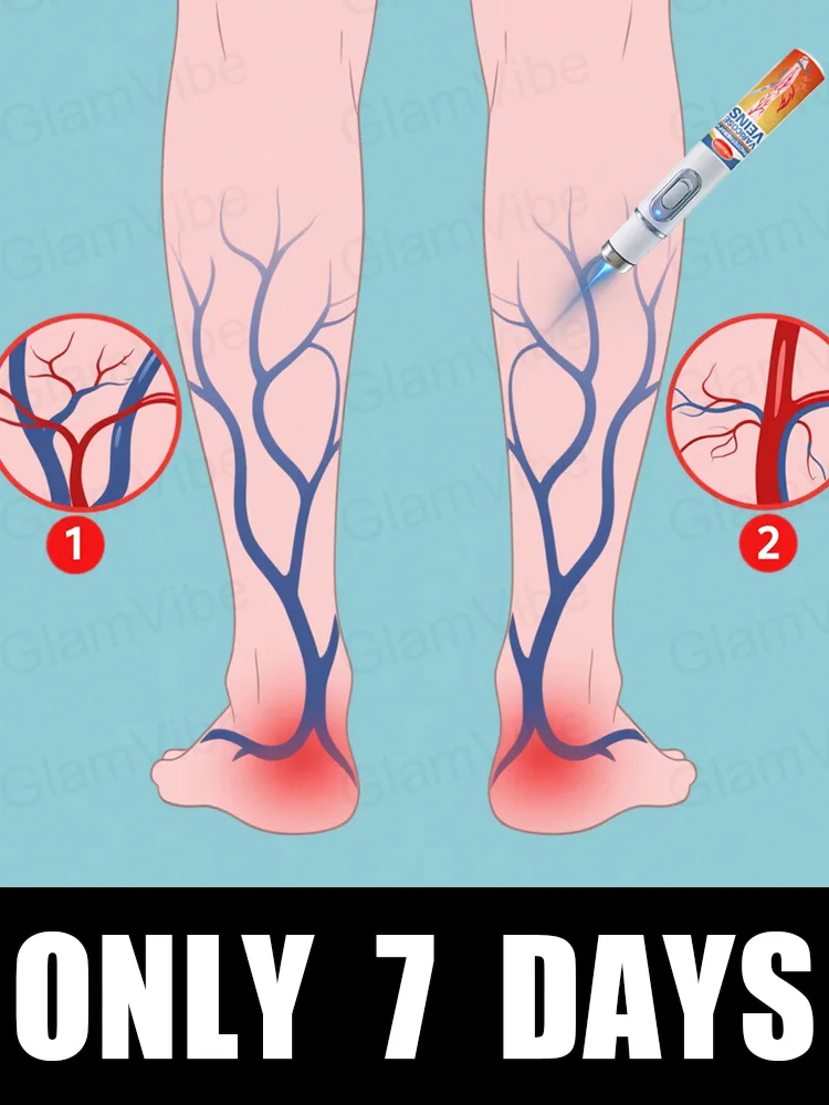 

blue light pen solve varicose veins, hot sale leg care tools
