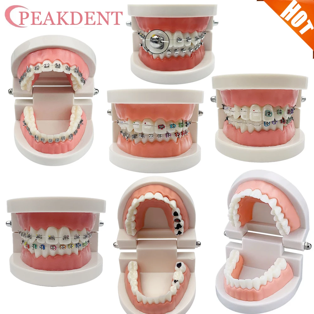

Dental Teaching Model Adult Standard Orthodontic With Braces Metal Ceramic Brackets Dentistry Studying Education Model