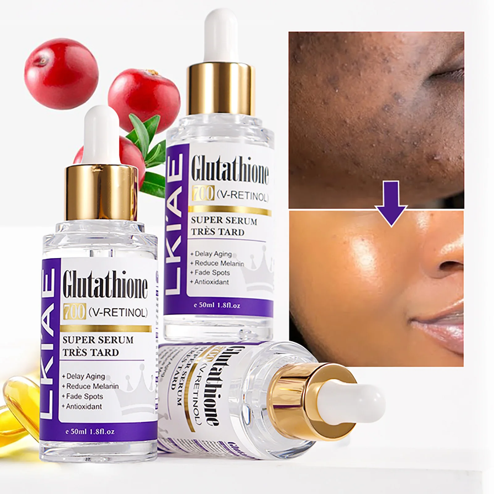 

LKIAE Отбеливающая сыворотка для лица с глутатионом, удаление меланина, темных пятен, хлоазма, с ретинолом, ниацинамидом, для всех типов кожи