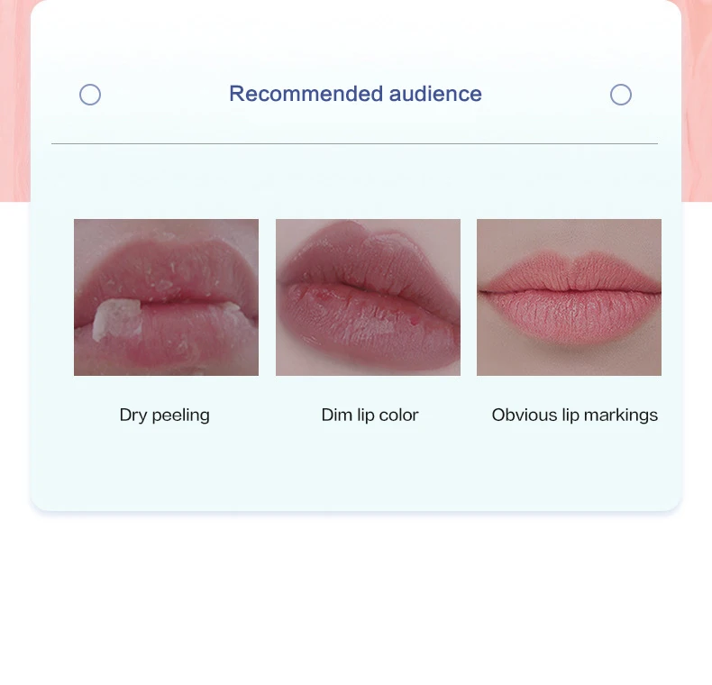 4/6/8 stücke Feuchtigkeitsspendende Lip Balm Set Bleaching Feuchtigkeitsspendende Basis Natürliche Pflanzen Basis Feuchtigkeitsspendende Riss Lippen Pflege Gelee Feuchtigkeitscreme – Detail 2