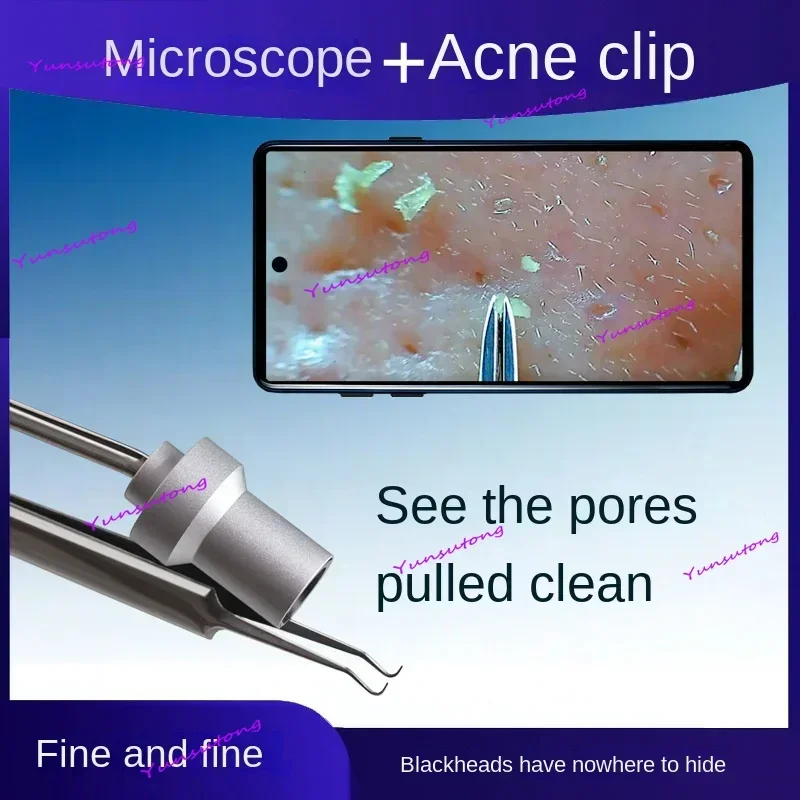 

visual acne clip, ultra-clear camera blackhead remover, microscope tweezers