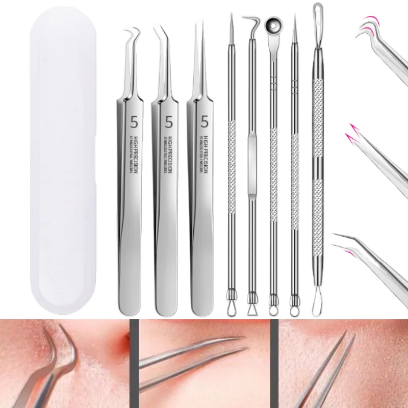 3-8 個にきびクリップにきび除去ニキビピンセットステンレス鋼セルクリップにきび針美容製品スキンクリーニングツール