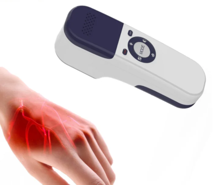 Factory high quality portable  vein finder baby  vein locator for clinic and hospital