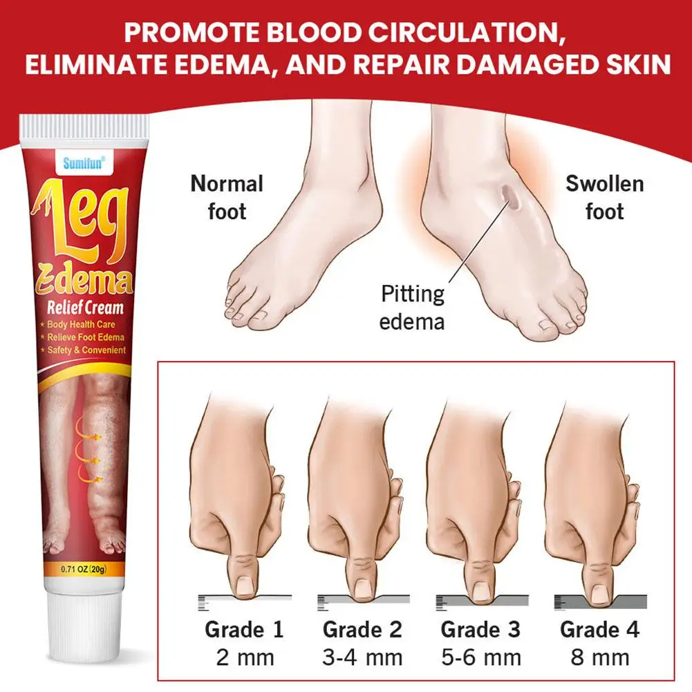Leg Anti Swelling Care Cream 20g Promotes Blood Circulation, Relieves Muscle Swelling/Leg Swelling