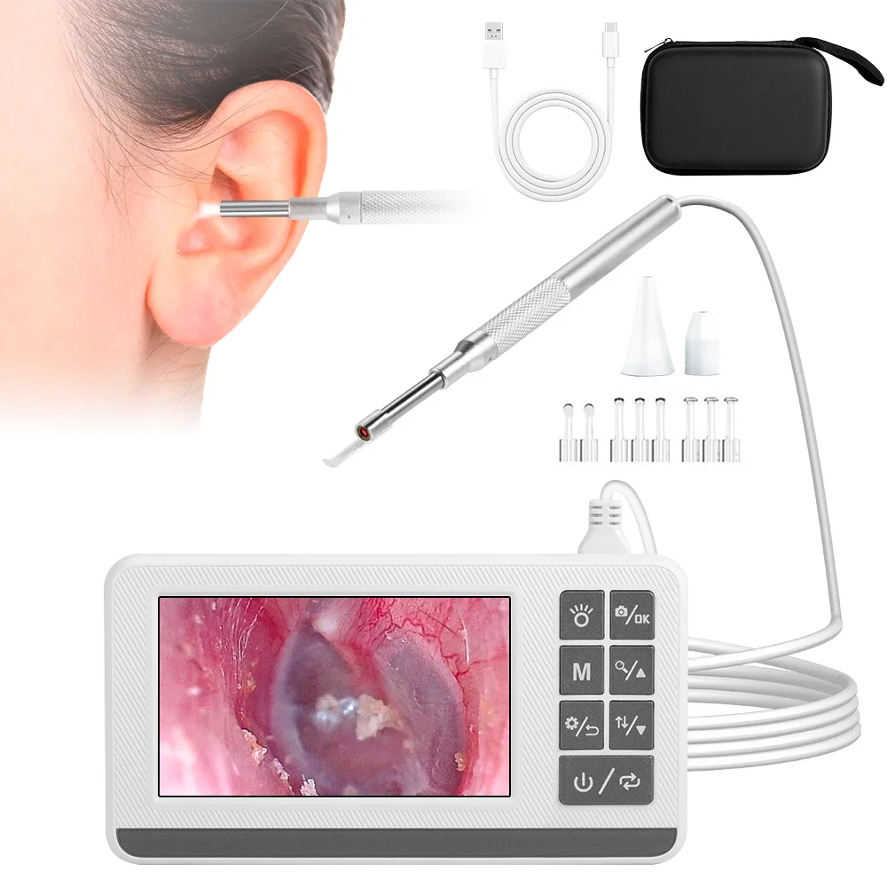 KERUI Visual Ear Wax Visual Cleaner with 4.3 inch Screen 3.9mm Earwax Removal Otoscope Camera Tooth Ear Care Pick Cleaning Tools