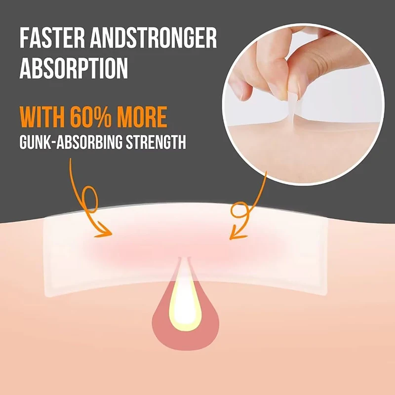 30PCS/SET Pimple Patch Acne Invisible Acne Removal Skin Care Concealer Face Spot Absorbing Healing Beauty Cosmetics