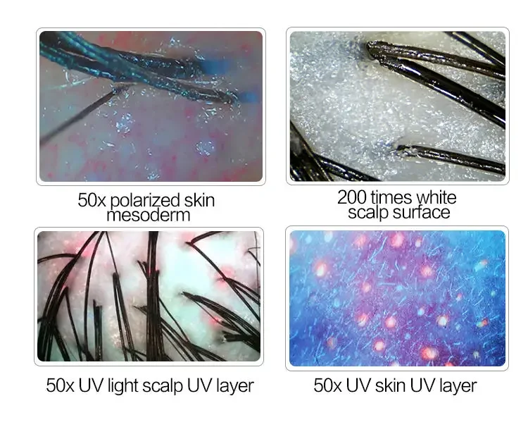 2024 HD Hair Follicles Scalp Detector Scanner Hair Analyzer Scalp Hair Analysis Machine Professional