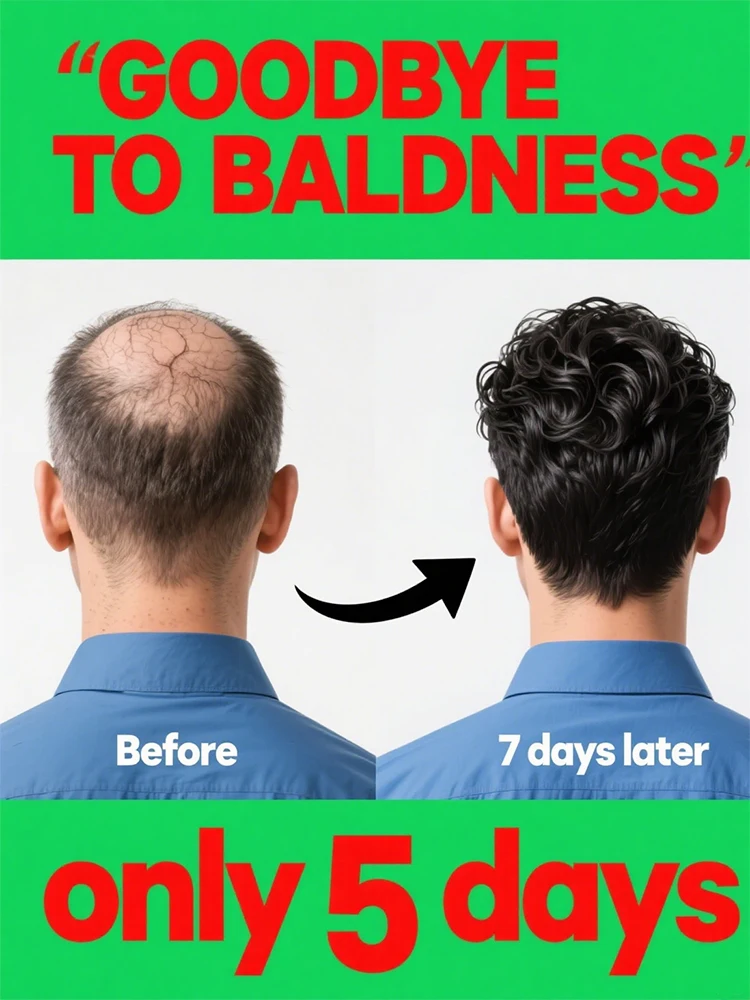 

Limited time discount on baldness and hair loss care kits,