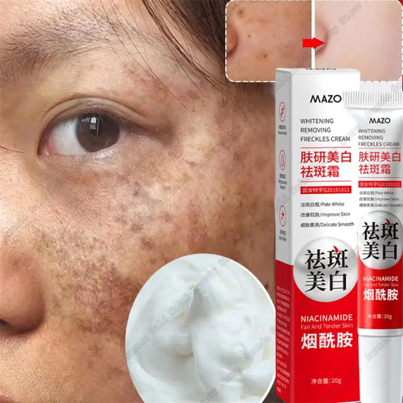 

Effective Whitening Freckle Face Cream Remove Dark Spots Fade Melasma Melanin Moisturizing Brighten Improve Dullness Skin Care