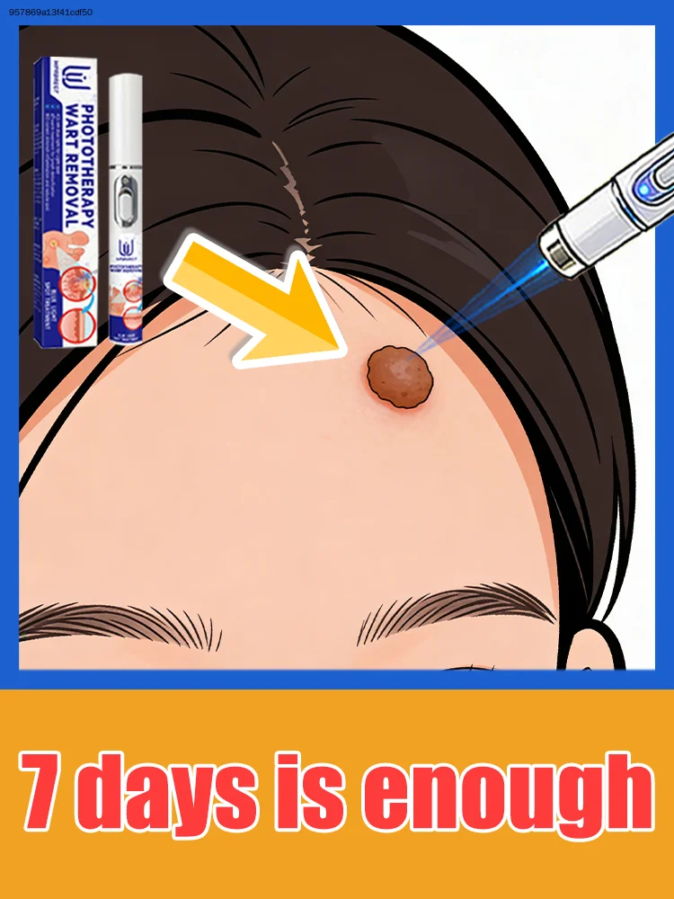 

Generation-3 Laser Says Goodbye To Warts In 7 Days