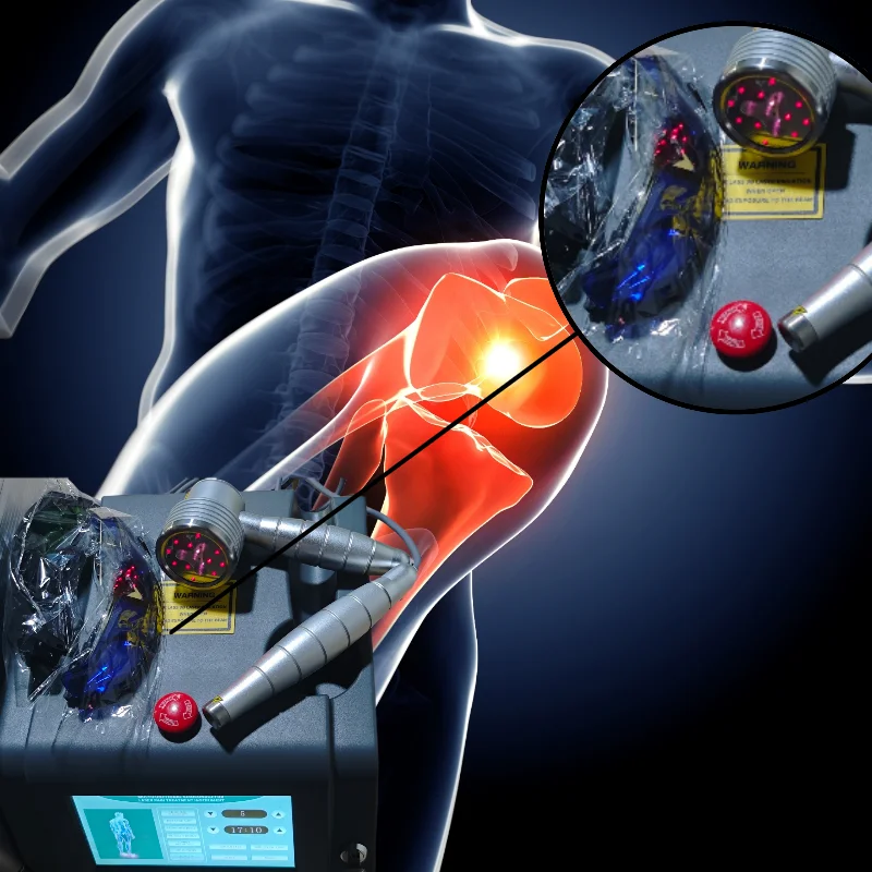 808nm iLIB Laser Therapy Machine Extracorporeal Physiotherapy Device with Dual Wavelengths for Cell Regeneration & Pain Relief