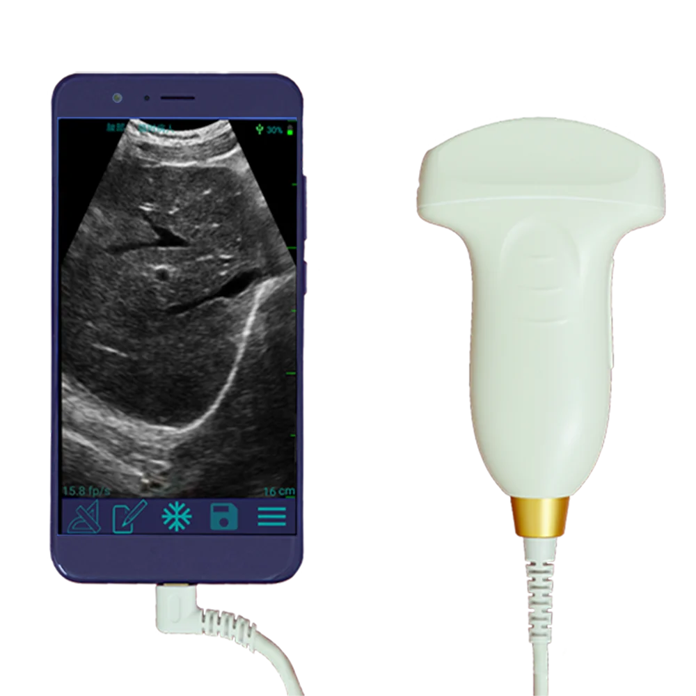 

Amain MagiQ MPUC 5-2 Black and White Convex Palm Vascular Endoscopic Ultrasound GE Facility Ultrasound Probe