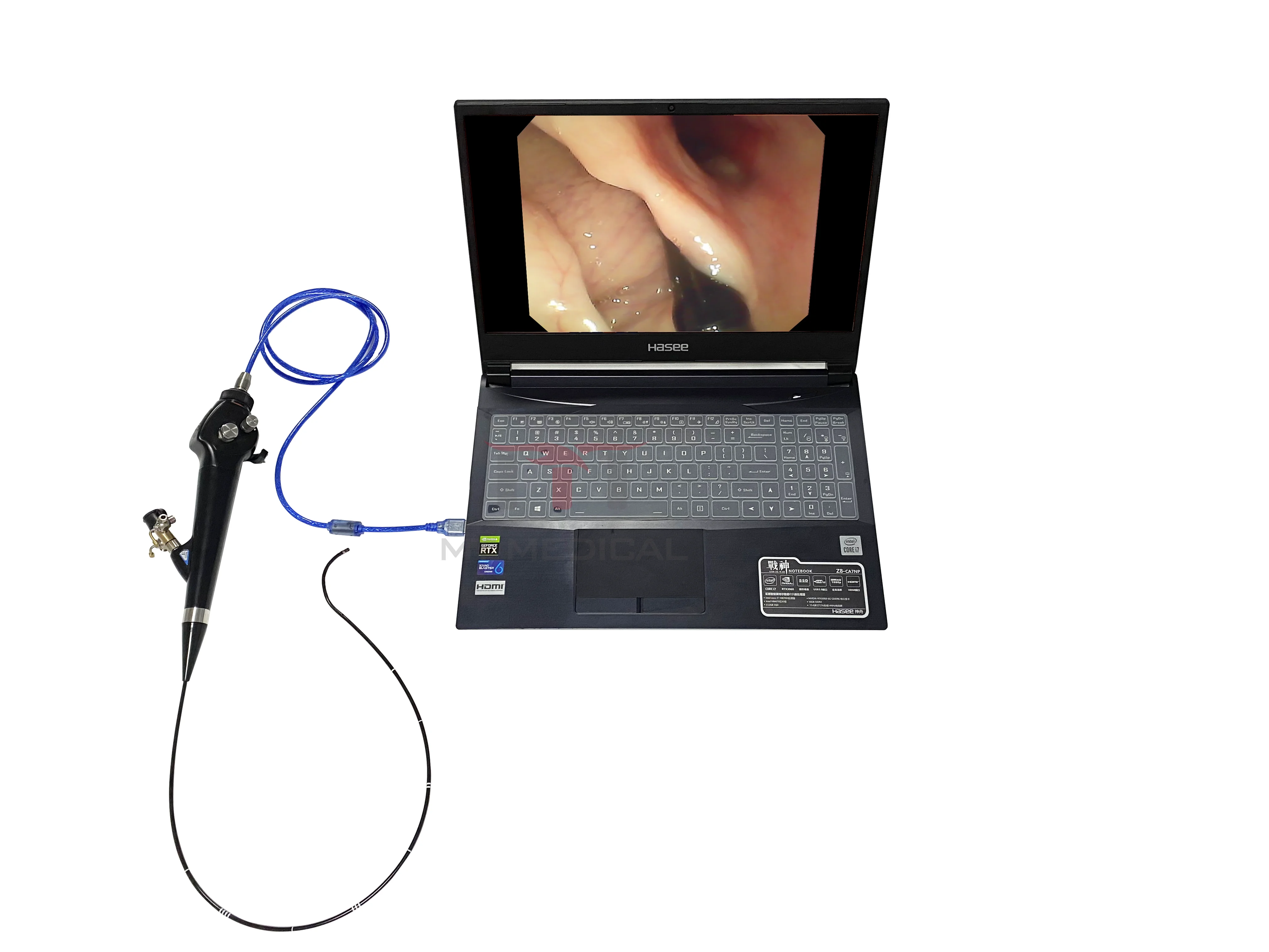 MT MEDICAL Portable Flexible Video Laryngoscope Bronchoscope Nasopharyngoscope Cystoscope Choledochoscope Ureteroscope