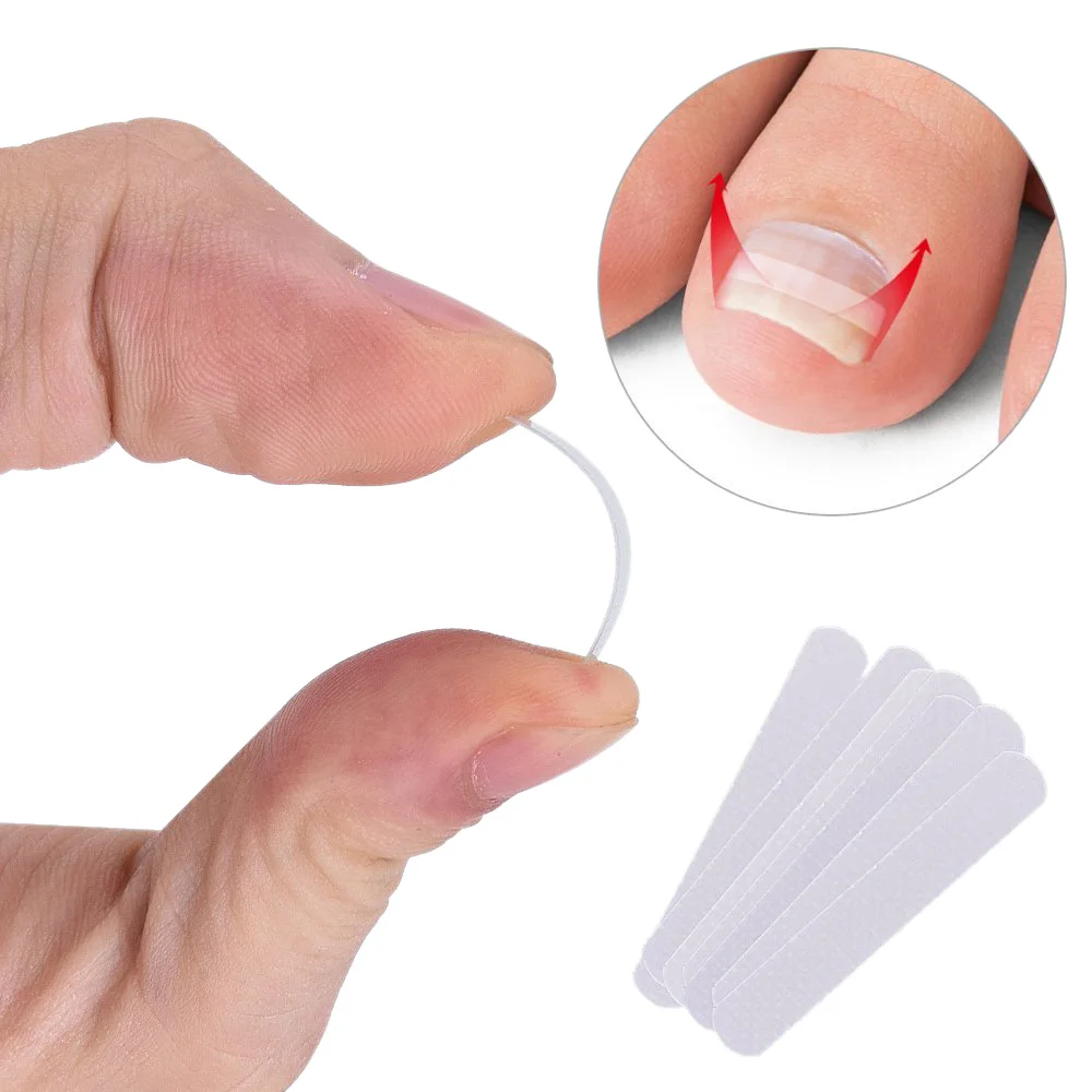 PARON-Outil de pédicure pour ongles incarnés, pince à redresser, attelle Bs incurvée, outil de paronyamitié optique, 10 pièces par bouteille