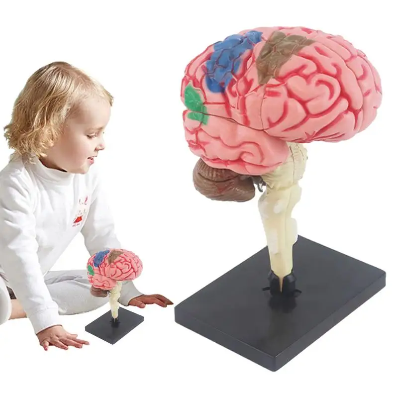 

Brain Model For Kids Teaching Brain Model Teaching Med Model Color-Coded Artery Brain DIY Teaching Anatomy Model For Science