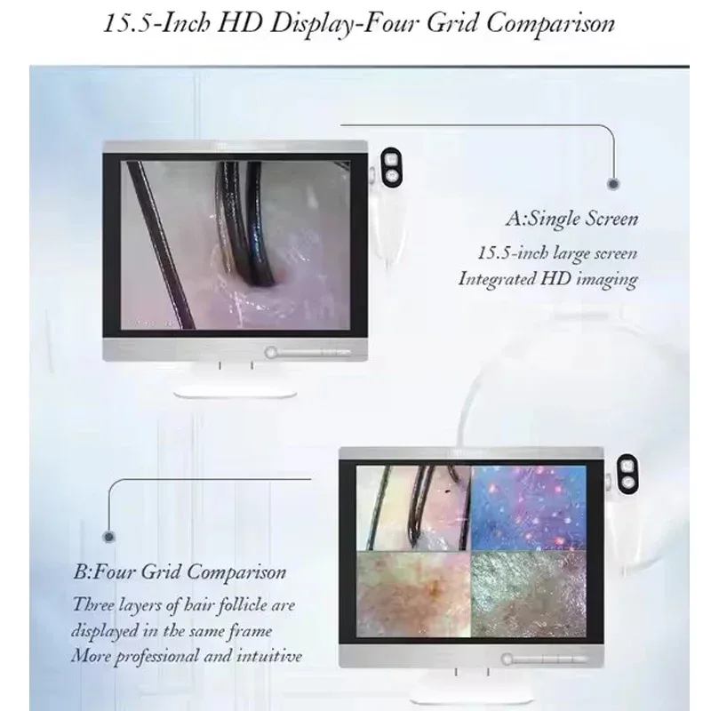 15 بوصة HD كاشف بصيلات الشعر الاحترافي محلل الجلد الرقمي أداة المجهر عالية الدقة اختبار الجلد 50/200X
