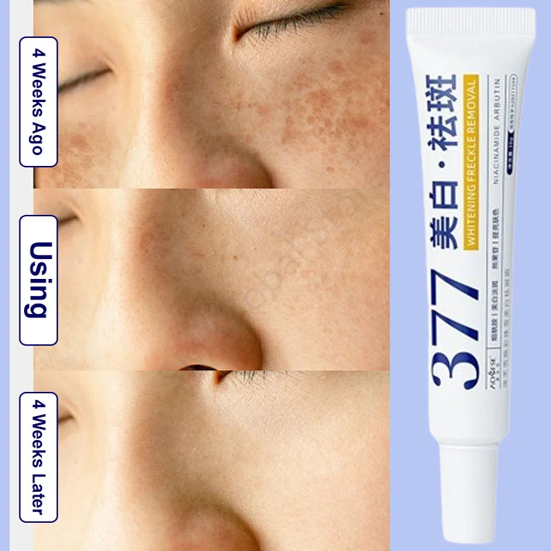 377 Whitening Freckle Cream Lighten Dark Spots Improve Dull Skin Tone Moisturizing Brightening Lotion Set For Women Men New 2024