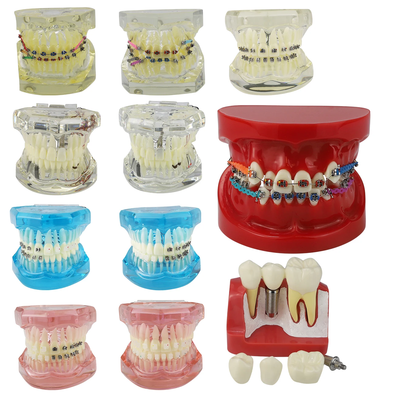 Nowa choroba implantu dentystycznego Model zębów Model ortodontyczny nauczanie nauka medyczna praktyka ortodoncja Model leczenia