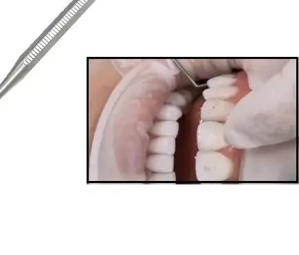 

Dental Veneer Removal Tool Stainless Steel with Sharp and Flat Tips for Porcelain Veneer Removal Orthodontic Instruments