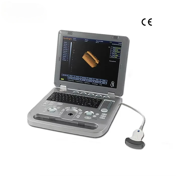 

Portable 3D 4D echo ultrasound machine cost effective human ultrasound