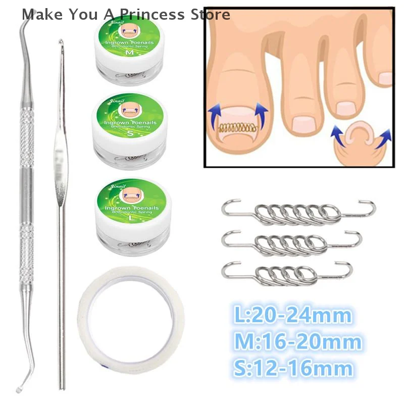 Ingrown Toenail Cor…