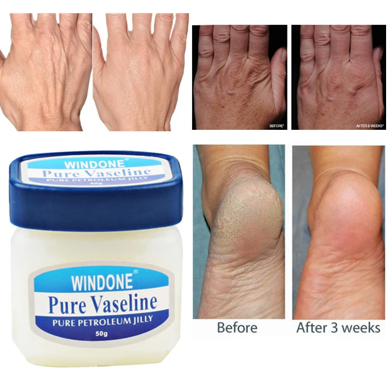 Vaseline Pure Petroleum Jelly Moisturizing Cream Anti Chapping Anti Cracking Hand Cream Foot Skin Protection Freeze Cream 50g