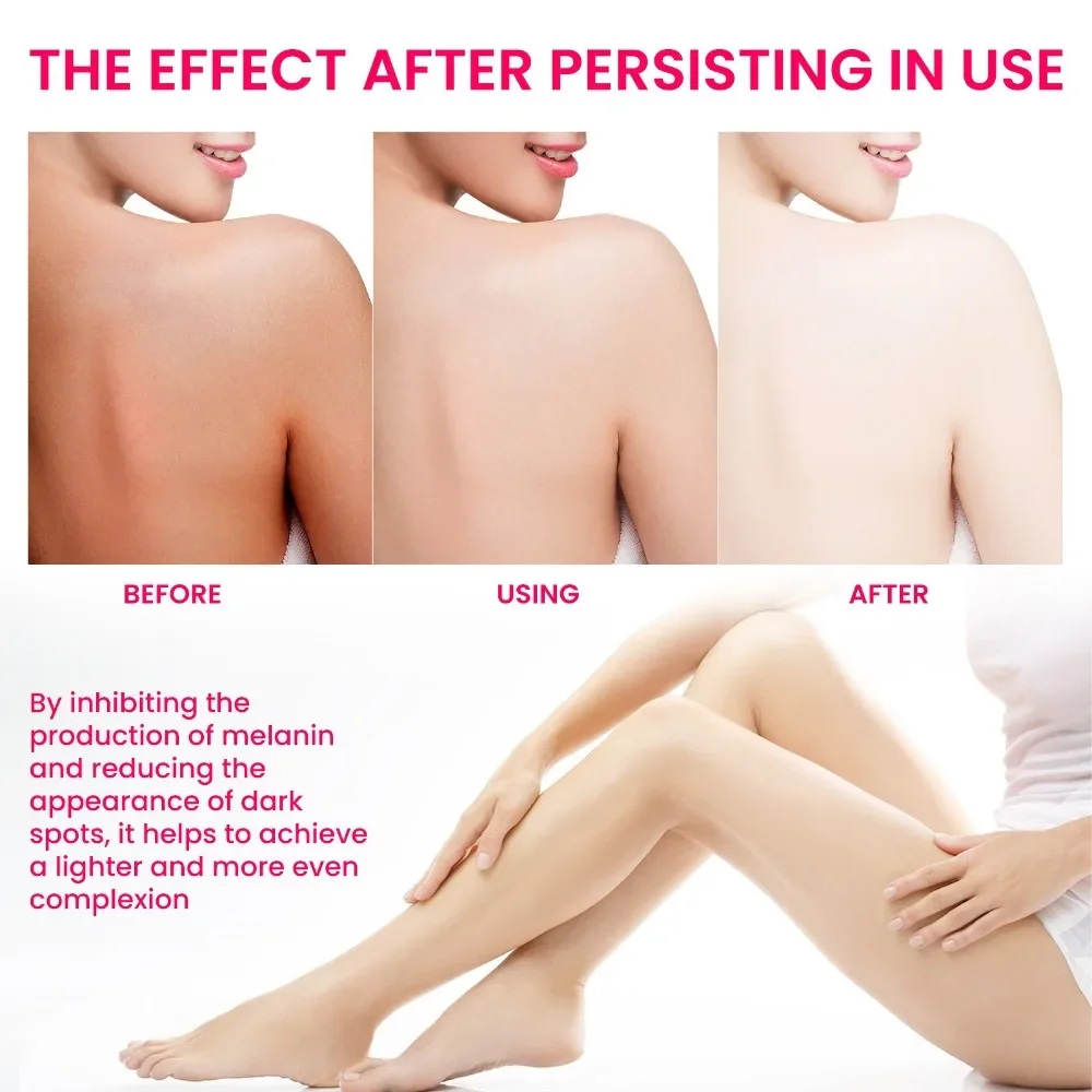 Women Armpit Lightening Cream Brightening Body Bleaching Cream Hand Knuckles Private Parts Brightening Emulsion Korean Skin Care