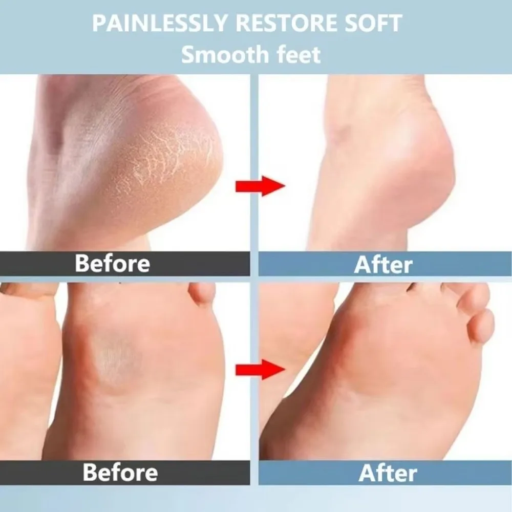 Nanoglas Hand Voet Bestand Eelt Remover Ovale Voet Wrijven Board Schrapen Hak Tool Dode Huid Remover Voet Scrubber