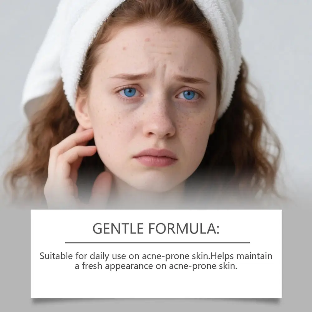 Patch de réparation d'acné, soins de la peau du visage, estompe les imperfections, mignon bouton, autocollants d'acné, outil de maquillage de beauté, 80 pièces