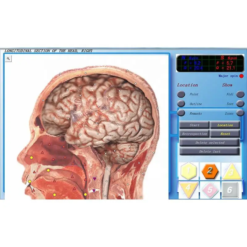 JYTOP-3D NLS التشخيص محلل الصحة ، للكشف عن الصحة