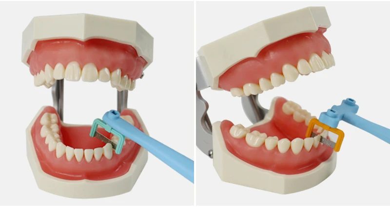 مجموعة تزجيج الأسنان ، أدوات تقويم الأسنان ، شفرة الرمل ، شريط ، قطعة مادة طب الأسنان ، 11