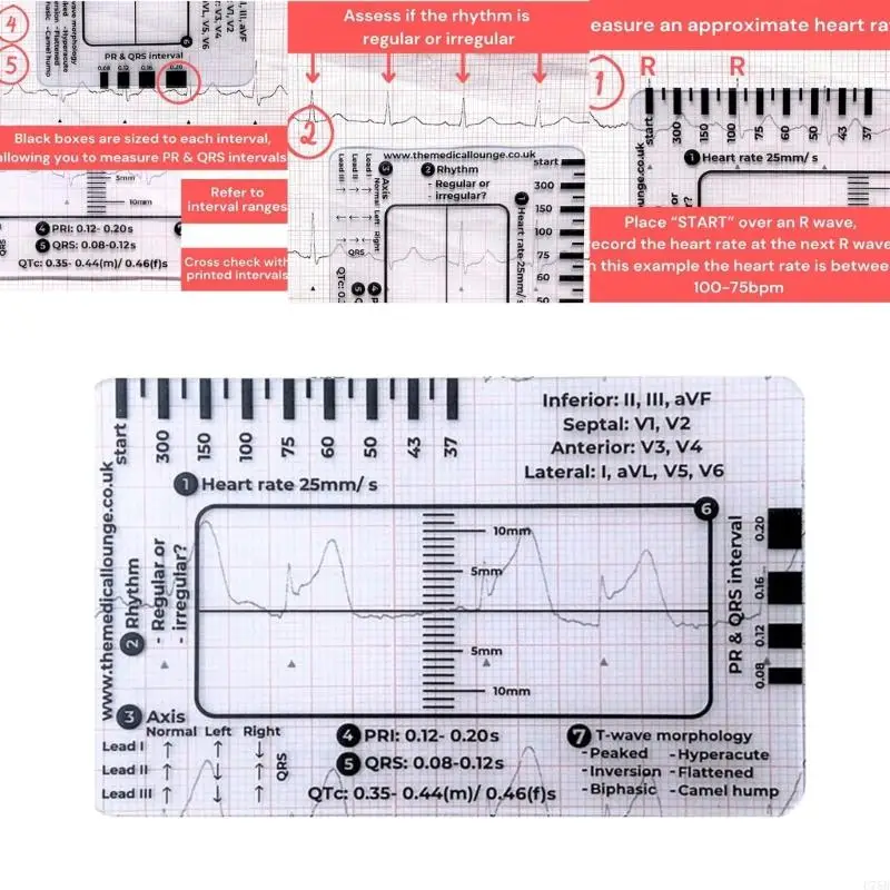 U75B Tragbare EKG-Interpretationsleitfadenkarte für eine genaue EKG-Interpretation