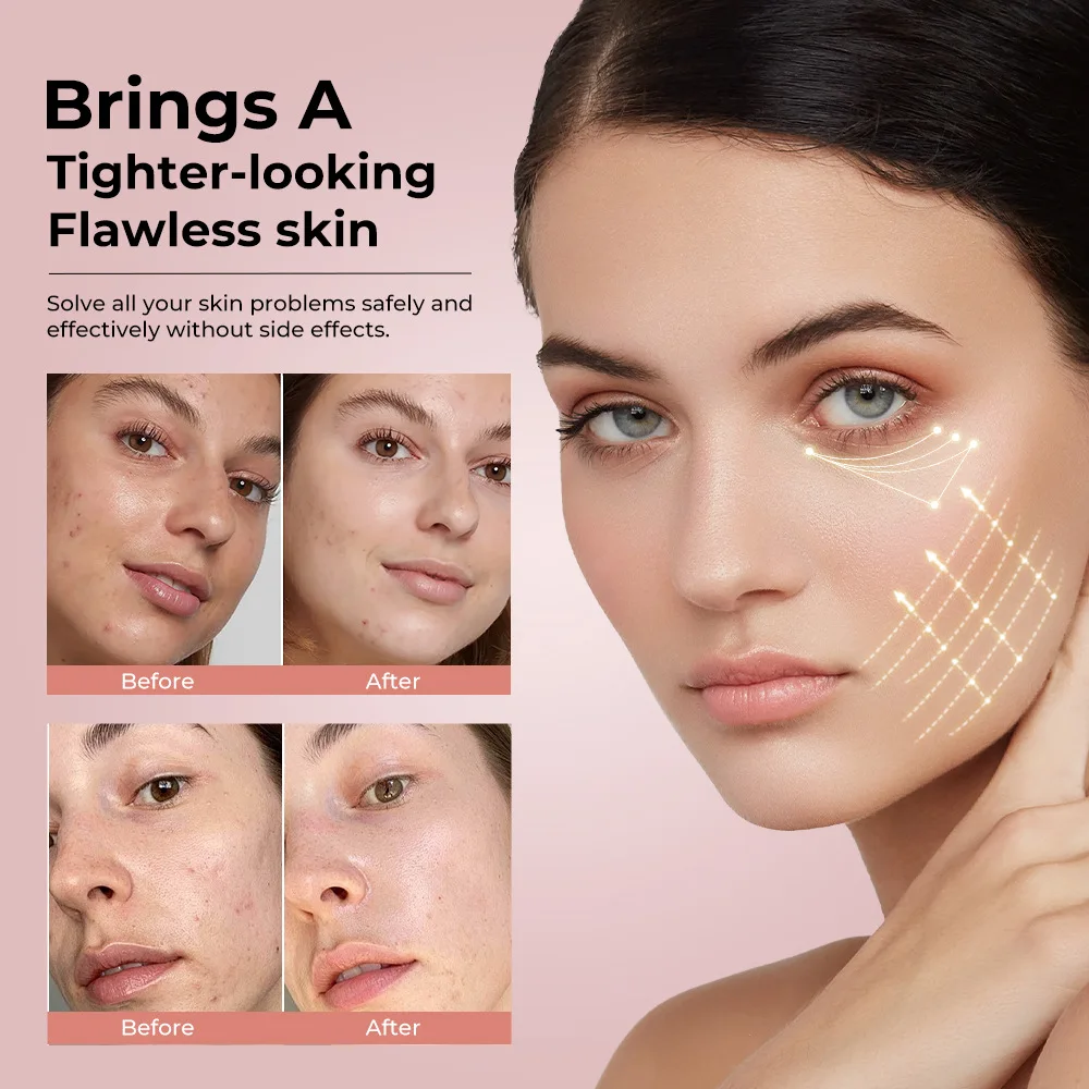 Neck and Hand Promotion: Introducing Tightening Microcurrent Facial 7-Color Light Handheld Beauty Device