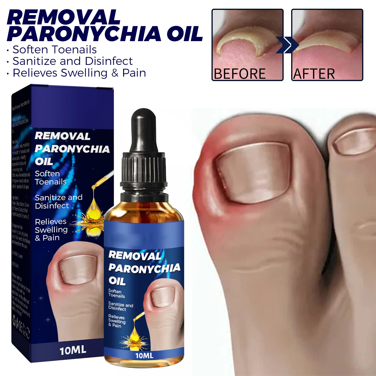 Foot Treatment Solution Professional Toe Nails Repair Nail Care Solution for Toenail