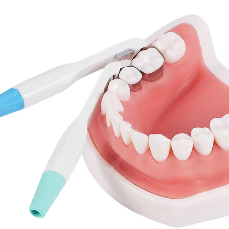 10 قطعة مصفوفة الأسنان الاقسام احيط المصفوفات الفرقة عدة حلقات معدنية طب الأسنان ماتريز المواد تشكيل تقويم الأسنان