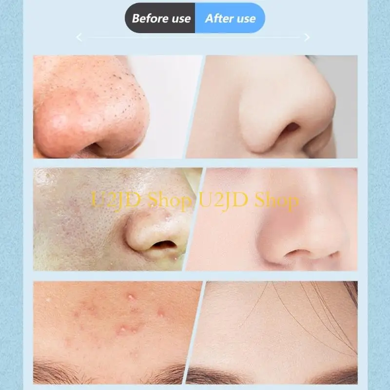 U2JD elektrische poriënreiniging voor gezichtsreiniging Blackhead Remover verstelbare stroom