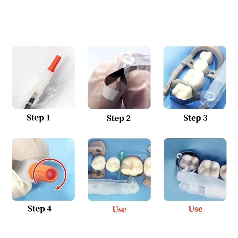 24-teiliges Zahnärztliches Matrizenband-Set, Sektionales Matrizensystem, Rollenförmige Matrizenbänder mit Halterung 180 ° Verstellbares Vorgeformtes Dentalwerkzeugmaterial – Detail 5