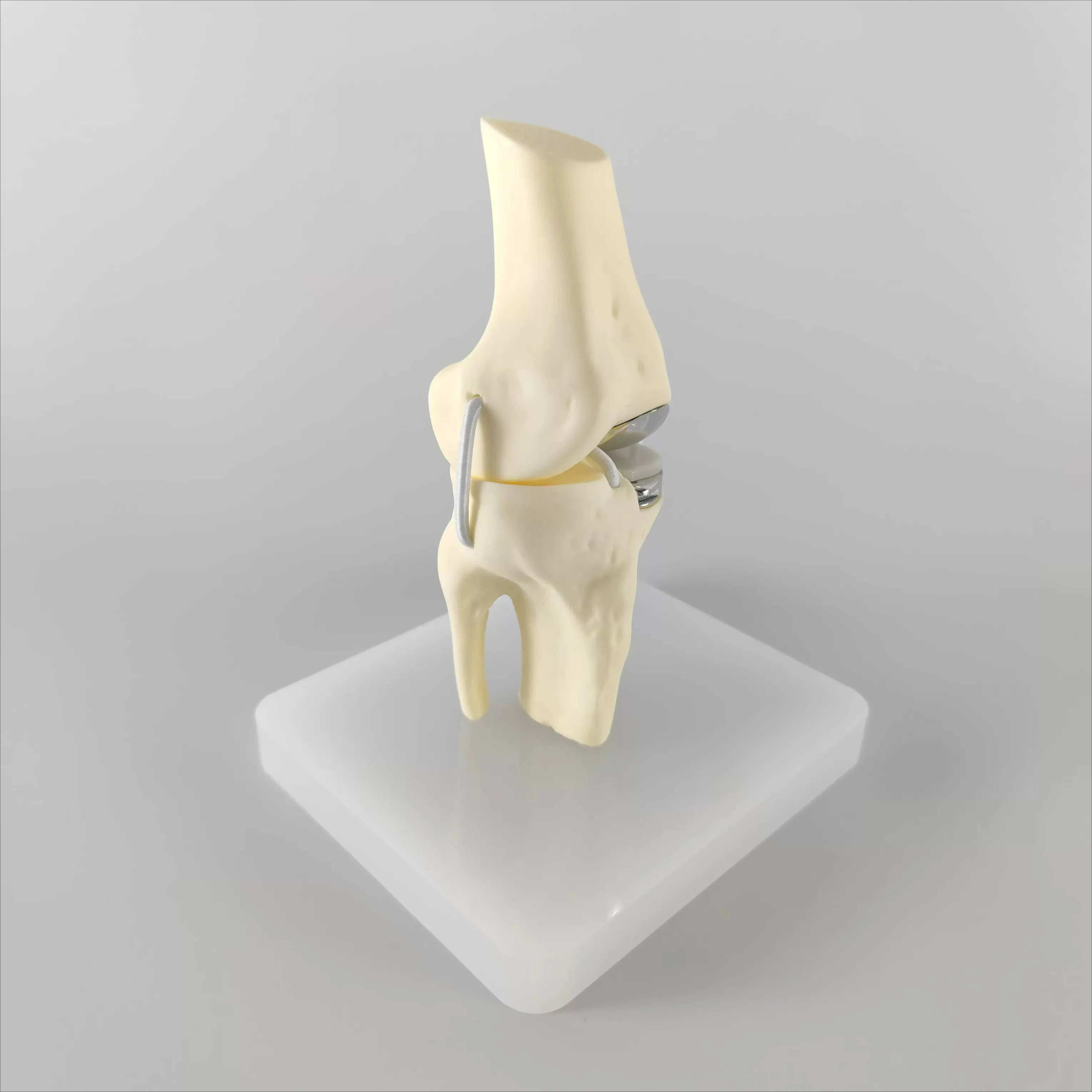 UKA TKA Knee Replacement Model, Mini Prosthesis Implant Demo for Patient Doctor Communication