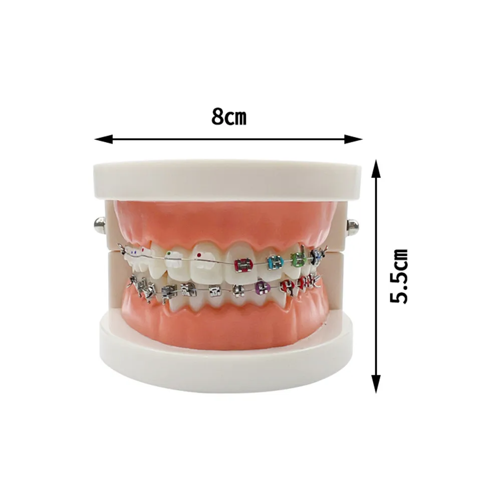 Model ortodontyczny z samodzielnym wspornikiem metalowym Aparat ceramiczny Typodont Stomatologia Zęby Nauczanie Studium Produkty demonstracyjne