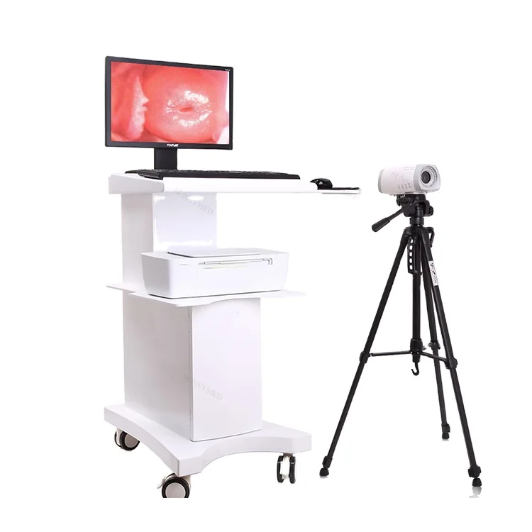 

Sy-F004 digital electronic video colposcope for gynecology Handheld Gynecology Colposcopy system