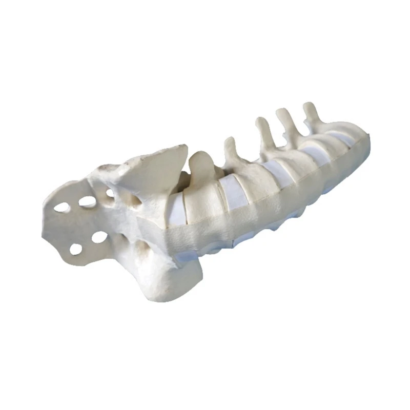 Human Lumbar Vertebrae Model with Sacrum Teaching Tool Lumbar Vertebrae Anatomically Model for Student Study Display Y3NC