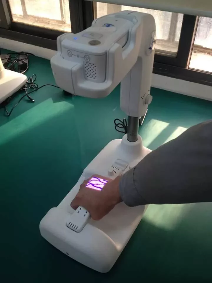 Portable Vein Finder Device YJ-VF26004 vascular imaging machine